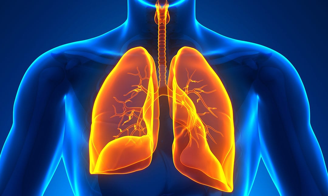 CALLING ALL LUNG NET AND NEC PATIENTS